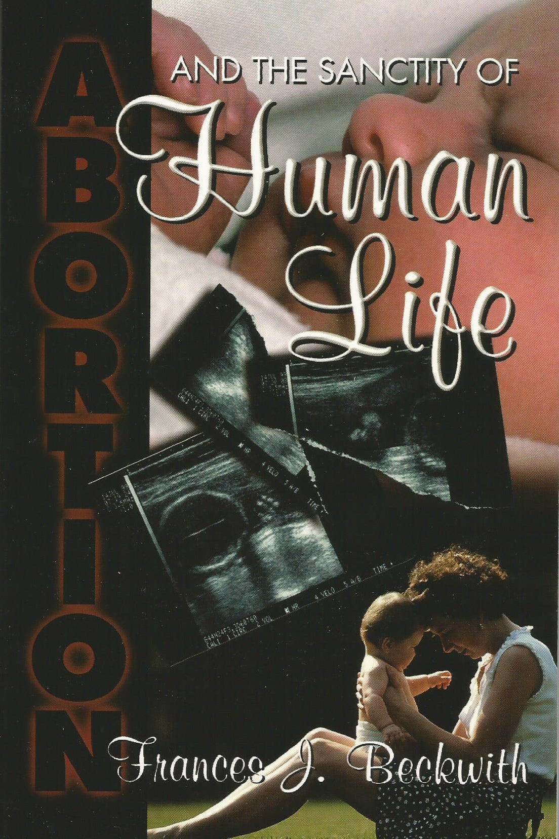 Abortion & The Sanctity Of Human Life